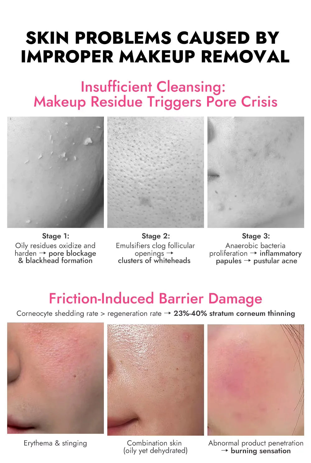 Lakerain – correcteur imperméable 5 couleurs, fond de teint mat, haute couverture, contrôle de l'huile, pour les cicatrices d'acné et les cernes, cosmétiques